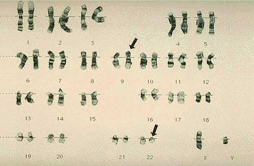Lastly among the types of the changes in chromosome structure is inversion.