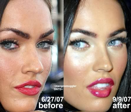 See Make Me Heal's story on Megan Fox's nose job. Posted Image